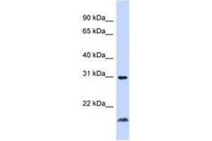 Image no. 1 for anti-Tumor Necrosis Factor (Ligand) Superfamily, Member 14 (TNFSF14) (C-Term) antibody (ABIN6744345) (TNFSF14 抗体  (C-Term))