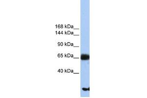 WB Suggested Anti-PIGO Antibody Titration:  0. (PIGO 抗体  (N-Term))