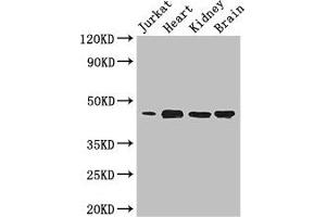 Western Blot Positive WB detected in: Jurkat whole cell lysate, Mouse heart tissue, Mouse kidney tissue, Mouse brain tissue All lanes: DOK2 antibody at 3. (DOK2 抗体  (AA 123-412))