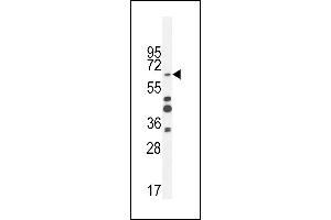 ZNF98 抗体  (C-Term)