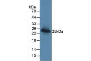 Detection of Recombinant LGALS3BP, Human using Monoclonal Antibody to Lectin Galactoside Binding, Soluble 3 Binding Protein (LGALS3BP) (LGALS3BP 抗体  (AA 24-221))