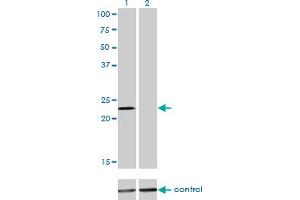 Western blot analysis of DENR over-expressed 293 cell line, cotransfected with DENR Validated Chimera RNAi (Lane 2) or non-transfected control (Lane 1). (Density Regulated Protein 抗体  (AA 1-81))