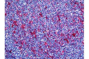 Anti-Gelsolin antibody IHC of human tonsil. (Gelsolin 抗体  (AA 673-783))