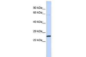 Western Blotting (WB) image for anti-ATP Synthase, H+ Transporting, Mitochondrial Fo Complex, Subunit B1 (ATP5F1) (Middle Region) antibody (ABIN2783271)