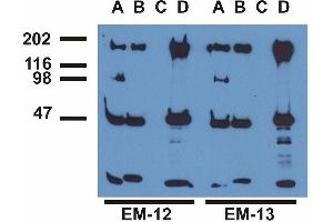 Immunoprecipitation ofEGFR from EGF-treated A431 cells by monoclonal antibodies EM-12 (A), (B), a commercial anti-EGFR polyclonal antibody (C)and anti-EGFR monoclonal mAb108 (D). (EGFR 抗体  (Tyr1173))