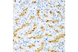 Immunohistochemistry of paraffin-embedded rat kidney using CCL22 antibody at dilution of 1:100 (40x lens). (CCL22 抗体)