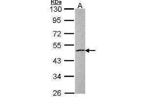 WB Image Sample (30 ug of whole cell lysate) A: NT2D1 10% SDS PAGE antibody diluted at 1:1000 (ZNF140 抗体)