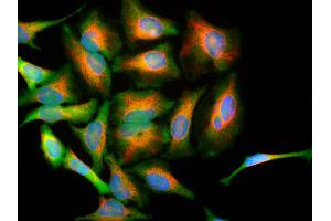 HeLa cells stained with PARK7 / DJ-1 antibody (green), and chicken antibody to vimentin (red) and DNA (blue). (PARK7/DJ1 抗体)