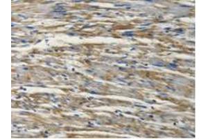 Figure. (PSMC4 抗体  (AA 1-418))