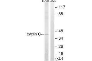Western blot analysis of extracts from LOVO cells, using Cyclin C (Ab-275) antibody. (Cyclin C 抗体  (Ser275))
