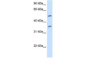 Western Blotting (WB) image for anti-Cytochrome P450, Family 2, Subfamily D, Polypeptide 6 (CYP2D6) (N-Term) antibody (ABIN630441)