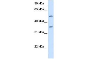 CYP2D6 antibody used at 2. (CYP2D6 抗体  (N-Term))