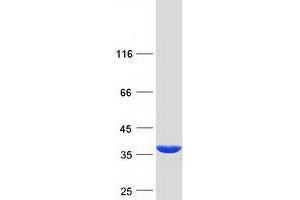 Western Blotting (WB) image for Peroxisomal Trans-2-Enoyl-CoA Reductase (PECR) protein (Myc-DYKDDDDK Tag) (ABIN2728636)