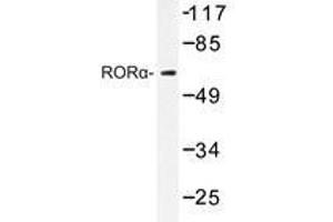 Western blot analysis of RORα antibody in extracts from HeLa cells.