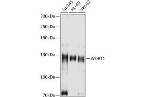 WDR11 抗体  (AA 975-1224)
