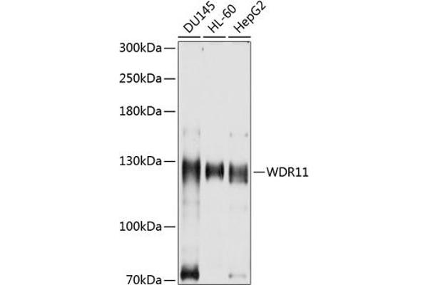 WDR11 抗体  (AA 975-1224)