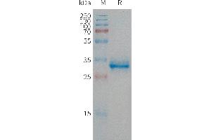 Human CGRP Protein, hFc Tag on SDS-PAGE under reducing condition.