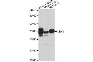 Western blot analysis of extracts of various cell lines, using CRY1 antibody (ABIN6291957) at 1:1000 dilution. (CRY1 抗体)