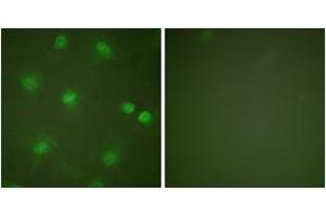 Immunofluorescence analysis of HeLa cells, using MEF2A (Ab-408) Antibody. (MEF2A 抗体  (AA 374-423))