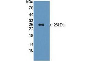 Detection of Recombinant PSMD5, Human using Polyclonal Antibody to Proteasome 26S Subunit, Non ATPase 5 (PSMD5) (Proteasome 26S Subunit, Non ATPase 5 (AA 143-341) 抗体)
