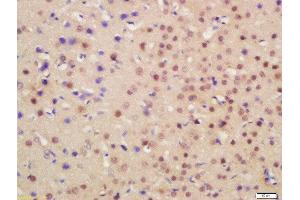 Formalin-fixed and paraffin embedded mouse brain labeled with Rabbit Anti-HRG beta 1 Polyclonal Antibody, Unconjugated  at 1:200 followed by conjugation to the secondary antibody and DAB staining (Hrg beta 1 (AA 65-150) 抗体)