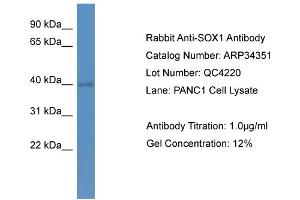 WB Suggested Anti-SOX1 Antibody   Titration: 1. (SOX1 抗体  (N-Term))