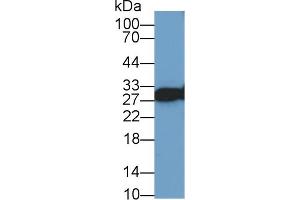 Western Blot; Sample: Human Lung lysate; Primary Ab: 1µg/ml Rabbit Anti-Human VAPA Antibody Second Ab: 0. (VAPA 抗体  (AA 1-249))
