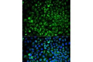 Immunofluorescence analysis of U2OS cells using COMT Polyclonal Antibody (COMT 抗体)