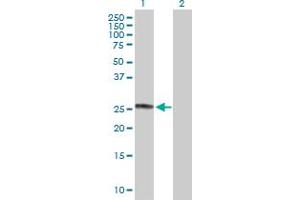 Western Blot analysis of CHCHD3 expression in transfected 293T cell line by CHCHD3 MaxPab polyclonal antibody. (CHCHD3 抗体  (AA 1-227))