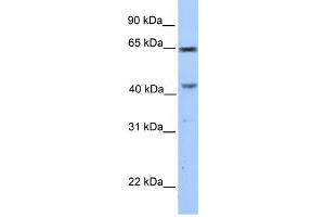 CCDC60 antibody used at 1 ug/ml to detect target protein. (CCDC60 抗体  (C-Term))