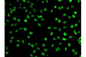 Immunofluorescence analysis of A-549 cells using PHF19 antibody (ABIN6128441, ABIN6145539, ABIN6145540 and ABIN6224090). (PHF19 抗体  (AA 1-207))