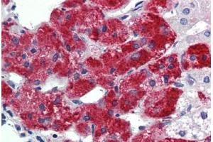 Human Adrenal: Formalin-Fixed, Paraffin-Embedded (FFPE) (TBX20 抗体  (N-Term))