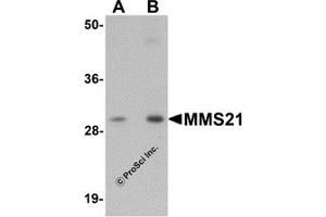 Western Blotting (WB) image for anti-E3 SUMO-Protein Ligase NSE2 (NSMCE2) (C-Term) antibody (ABIN1030522) (NSMCE2 抗体  (C-Term))