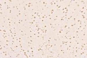 Immunohistochemistry analysis of paraffin-embedded rat hippocampus using,MED3 (ABIN7074581) at dilution of 1: 7200