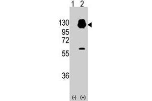 Western blot analysis of CDH13 (arrow) using rabbit CDH13 polyclonal antibody . (Cadherin 13 抗体  (N-Term))