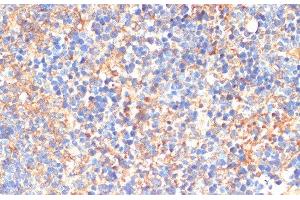 Immunohistochemistry of paraffin-embedded Mouse spleen using SIGLEC3/CD33 Polyclonal Antibody at dilution of 1:200 (40x lens). (CD33 抗体)