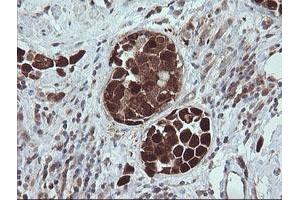 Image no. 4 for anti-Tripartite Motif Containing 44 (TRIM44) antibody (ABIN1501505)