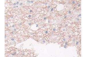 Immunohistochemistry (IHC) image for anti-Breast Cancer Anti-Estrogen Resistance 1 (BCAR1) (AA 1-240) antibody (ABIN7436351)