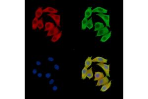 ABIN7095504 and ABIN7099561 staining Hela cells by IF/ICC. (VMP1 抗体)
