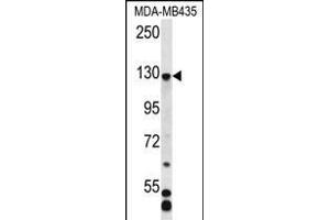 C7orf63 Antibody (N-term) (ABIN656362 and ABIN2845659) western blot analysis in MDA-M cell line lysates (35 μg/lane). (C7orf63 抗体  (N-Term))