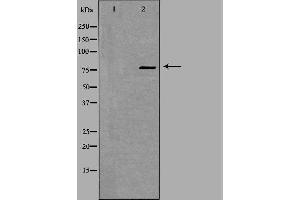 Western blot analysis of extracts from K562 cells, using ZNF420 antibody. (ZNF420 抗体  (Internal Region))