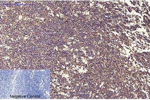 Immunohistochemical analysis of paraffin-embedded human tonsil tissue. (Ubiquitin 抗体)