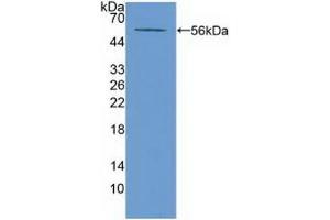 Detection of Recombinant ABCA13, Mouse using Polyclonal Antibody to ATP Binding Cassette Transporter A13 (ABCA13) (ABCA13 抗体  (AA 4692-4931))