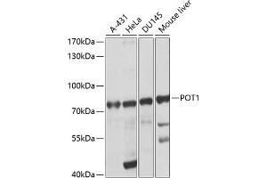 Western blot analysis of extracts of various cell lines, using POT1 antibody (ABIN3022020, ABIN3022021, ABIN5663924 and ABIN6218570) at 1:1000 dilution. (POT1 抗体  (AA 497-634))