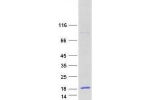 Validation with Western Blot