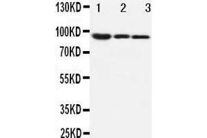 Anti-beta Catenin antibody, Western blotting Lane 1: MM453 Cell Lysate Lane 2: MCF-7 Cell Lysate Lane 3: HELA Cell Lysate (CTNNB1 抗体  (C-Term))