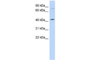 WB Suggested Anti-C1orf177 Antibody Titration: 0. (C1orf177 抗体  (Middle Region))