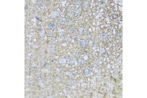 Immunohistochemistry of paraffin-embedded rat brain using B2 antibody (ABIN7265773) at dilution of 1:100 (40x lens). (ATP1B2 抗体  (AA 68-290))