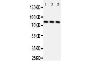 Western Blotting (WB) image for anti-Ribosomal Protein S6 Kinase, 90kDa, Polypeptide 1 (RPS6KA1) (AA 721-735), (C-Term) antibody (ABIN3042929)
