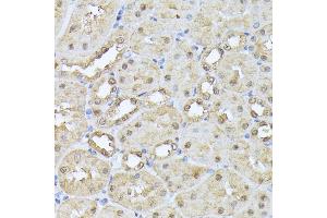 Immunohistochemistry (IHC) image for anti-Proteasome Subunit beta 3 (PSMB3) (AA 1-205) antibody (ABIN6146317)